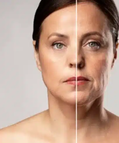 Comparison of facial aging
