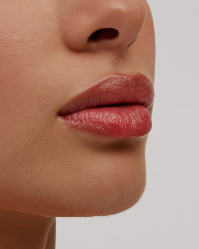 Lips after filler
