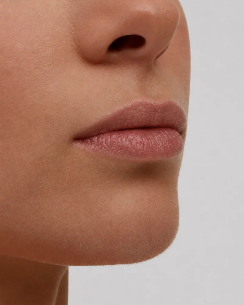Lips before filler
